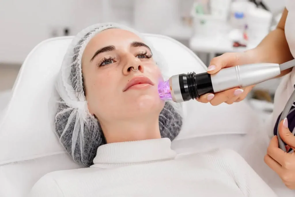 RF Microneedling in Beyond Wellness