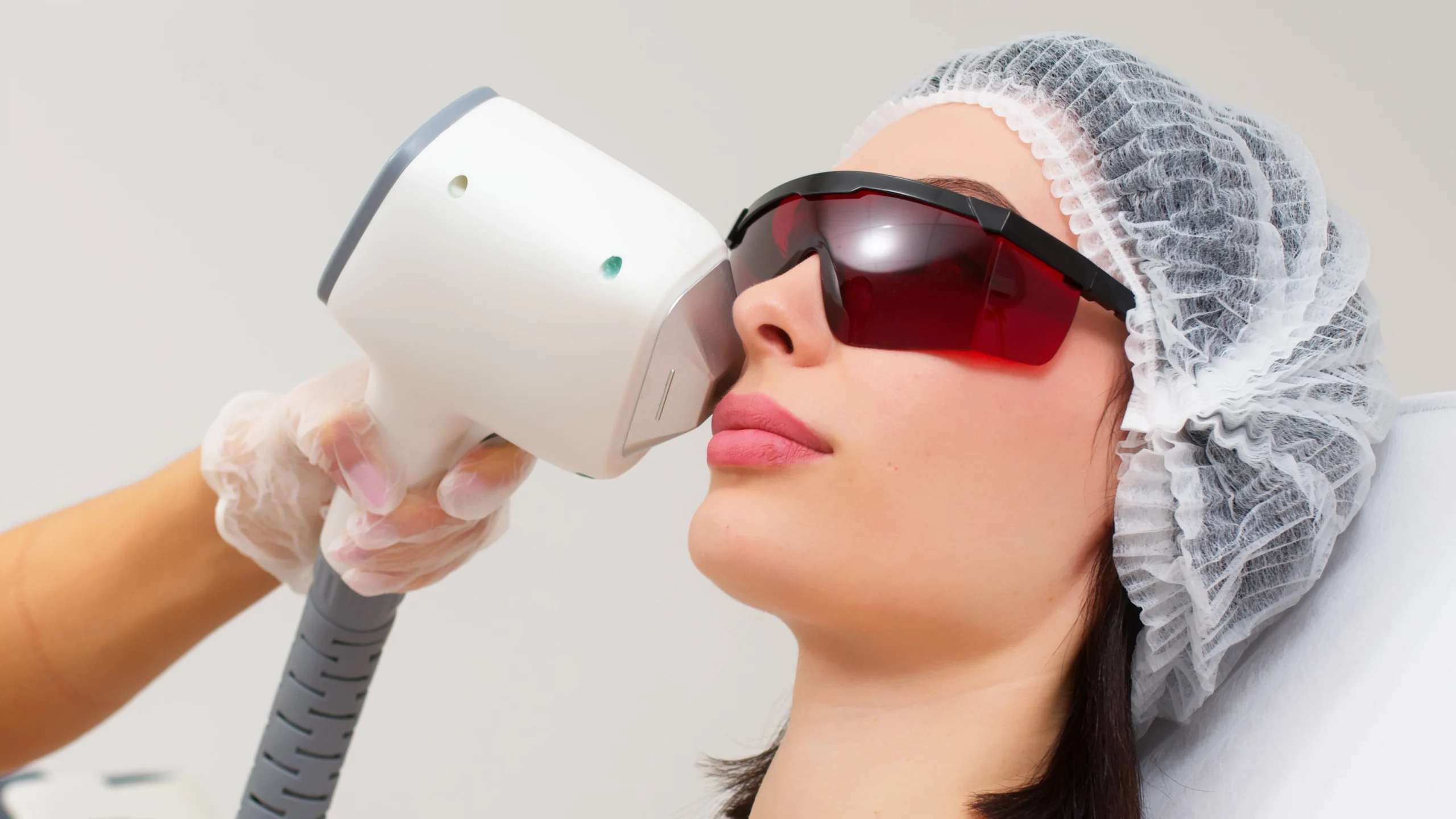 Sciton BBL Acne Treatment in Arkansas | Beyond Wellness
