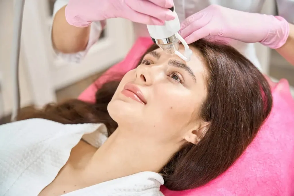 RF Microneedling Treatment in Little Rock